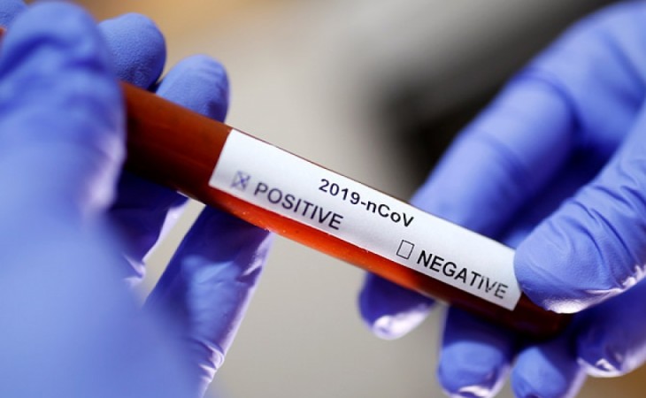 Son sutka ərzində Pakistanda 17 nəfər koronavirusdan həyatını itirib