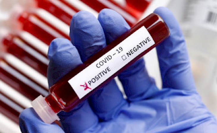 Son sutkada Pakistanda 300 nəfər koronavirusa yoluxub
