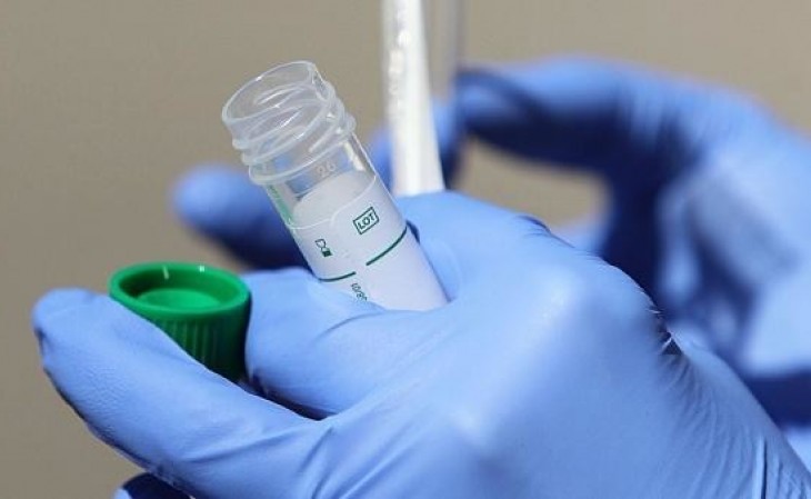 Son sutkada Qırğızıstanda koronavirusdan 9 nəfər ölüb