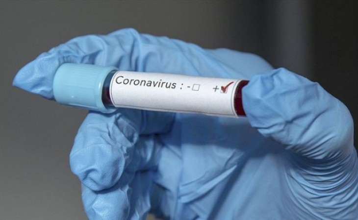 Ötən sutka Böyük Britaniyada koronavirusa 1406 nəfər yoluxub