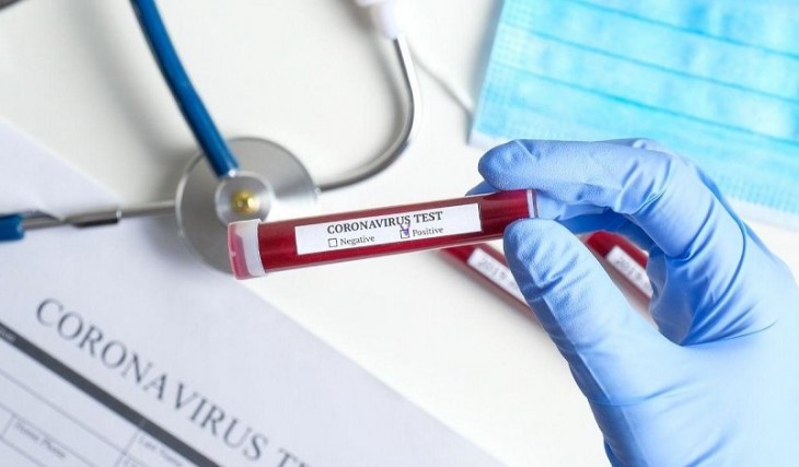 Koronavirusla əlaqədar 8015 test aparılıb