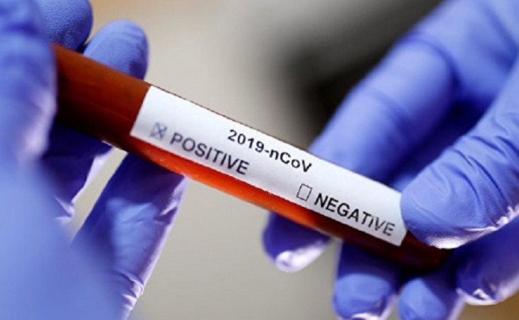 Ukraynada koronavirusa yoluxma hallarında yeni antirekord qeydə alınıb