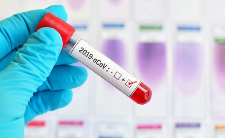 İndiyədək Azərbaycanda koronavirusa yoluxma hallarının müəyyənləşdirilməsi ilə əlaqədar 766 mindən çox test aparılıb